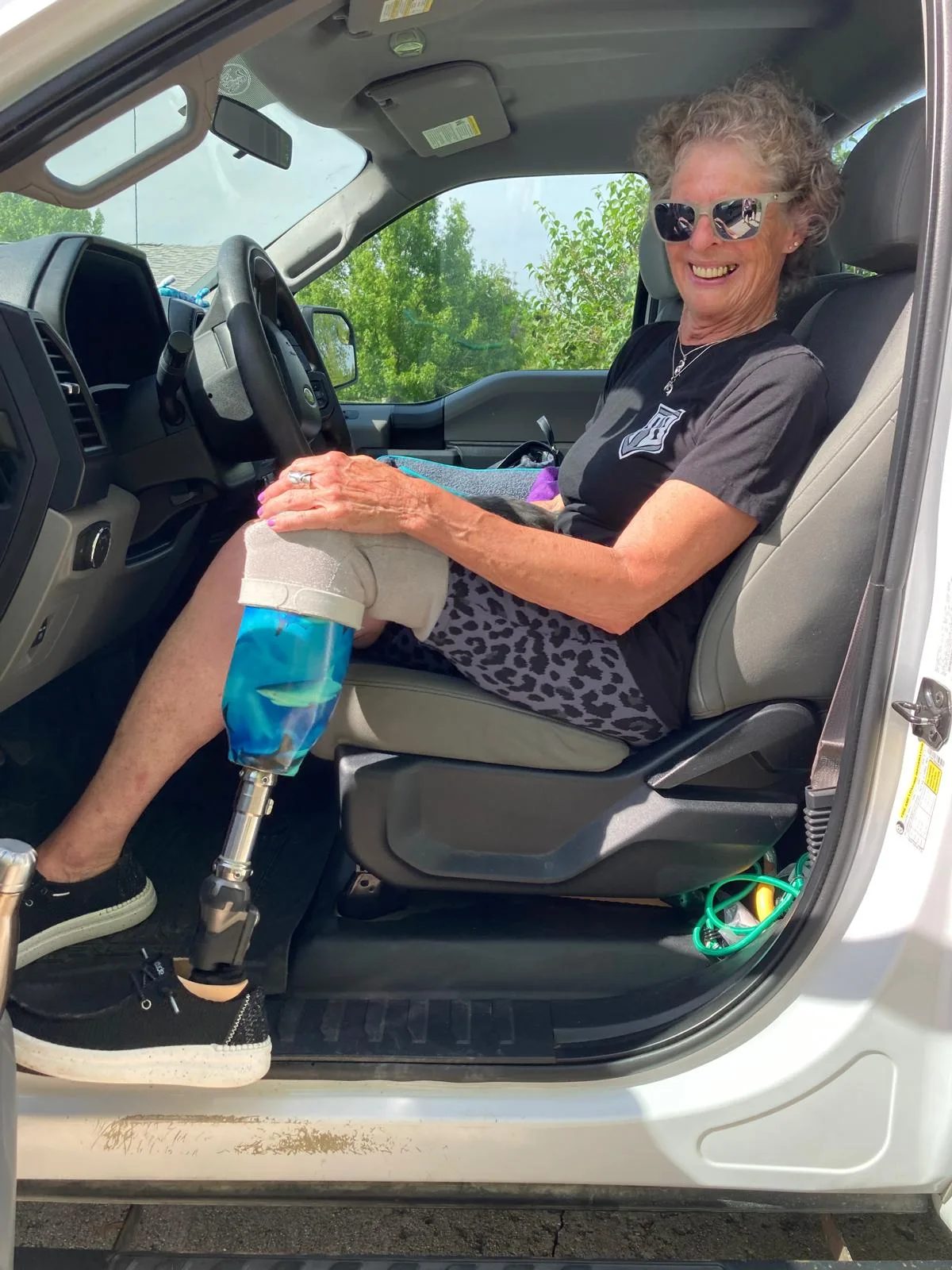 Image of woman sitting in car with leg prosthetic