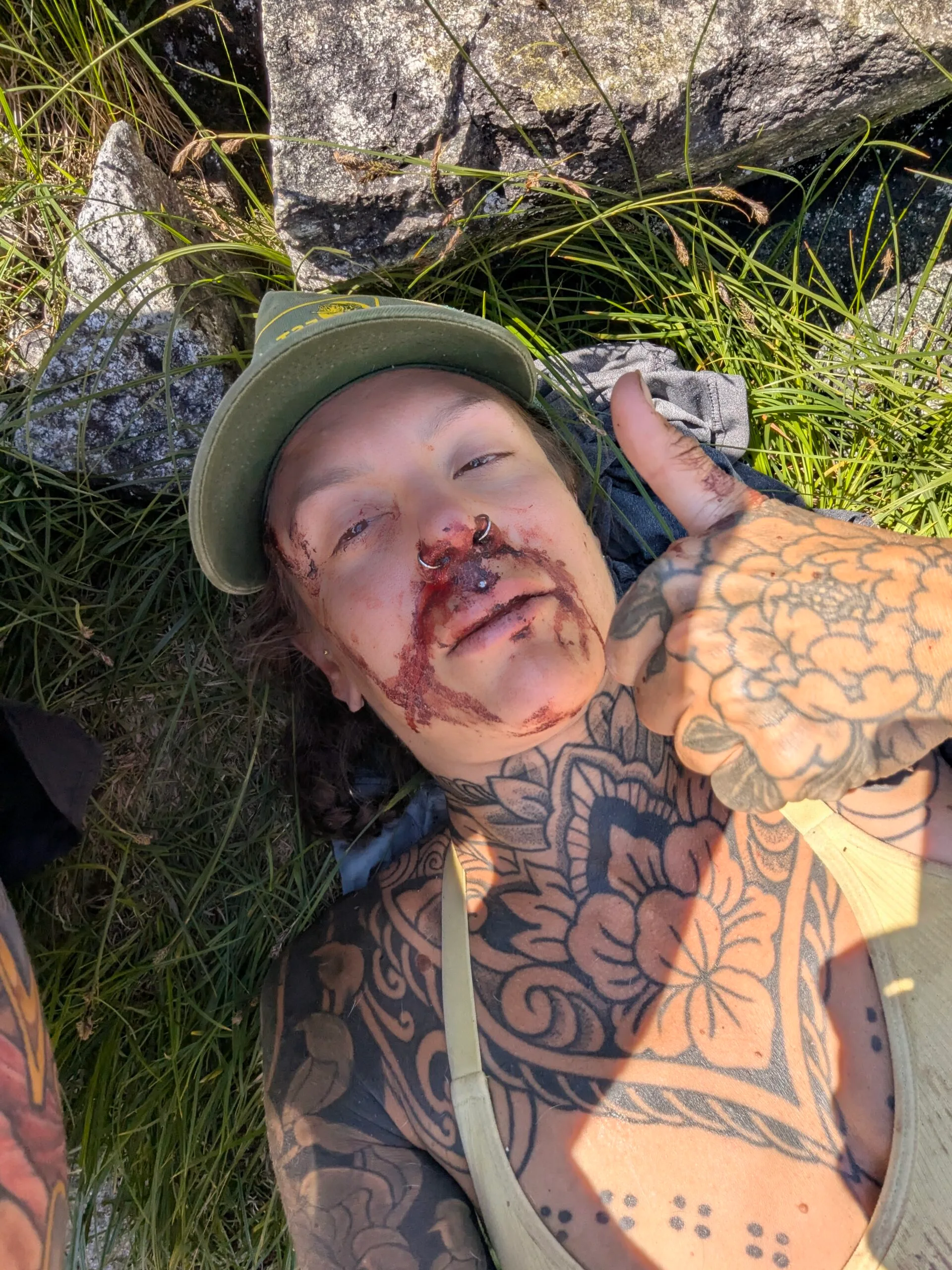 Image of woman after cliff fall