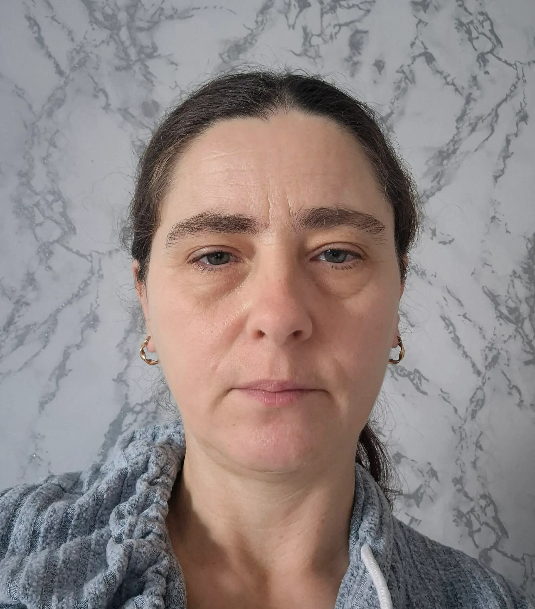Image of brave survivor