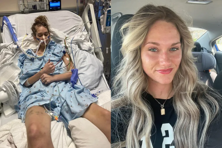 Image on left - woman recovering in hospital Image on right - woman with blond hair
