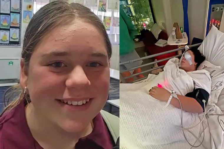 WA schoolgirl blinded by a magpie as she walked to school
