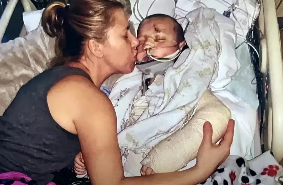 Image of young boy recovering in hospital after accident. He is covered in bandages and has tubes attached to his face. His mum, who has blonde hair and is wearing a grey singlet, is gently kissing his cheek.