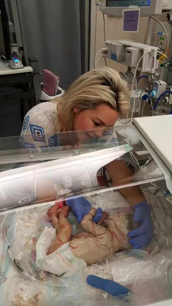 Image of newborn with skin condition