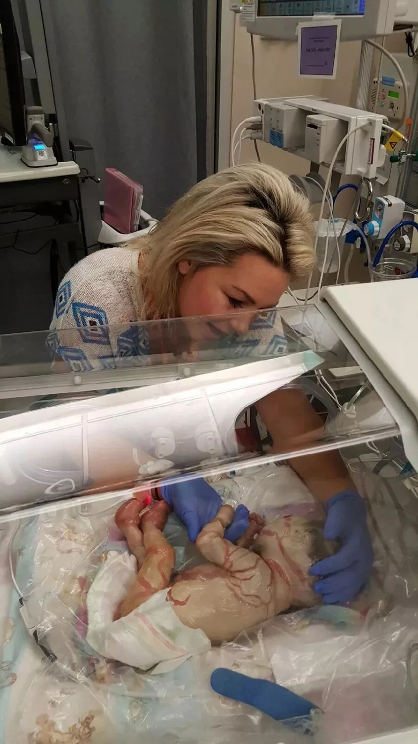 Image of newborn with skin condition