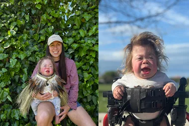 Mucolipidosis II awareness: ‘Willow’s smile lights up our world’
