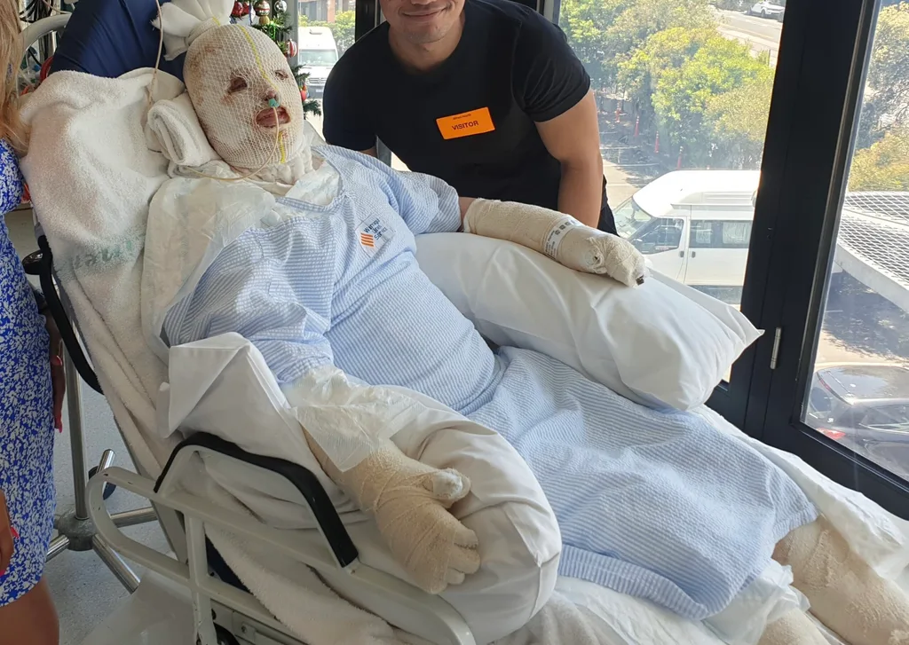 Image of woman recovering in hospital from volcano eruption