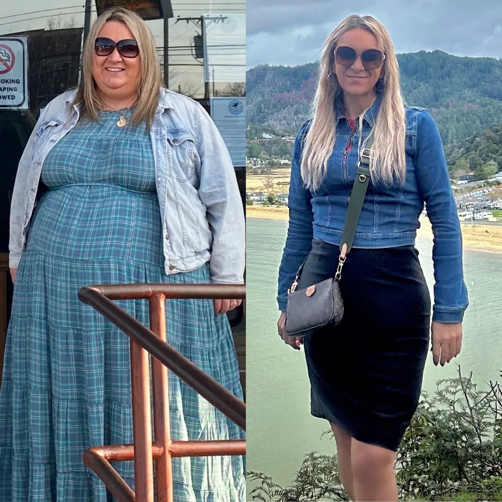 image of before and after weight loss surgery