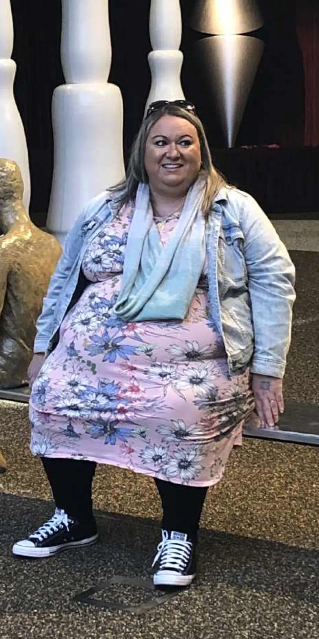 Image of woman before weight loss surgery