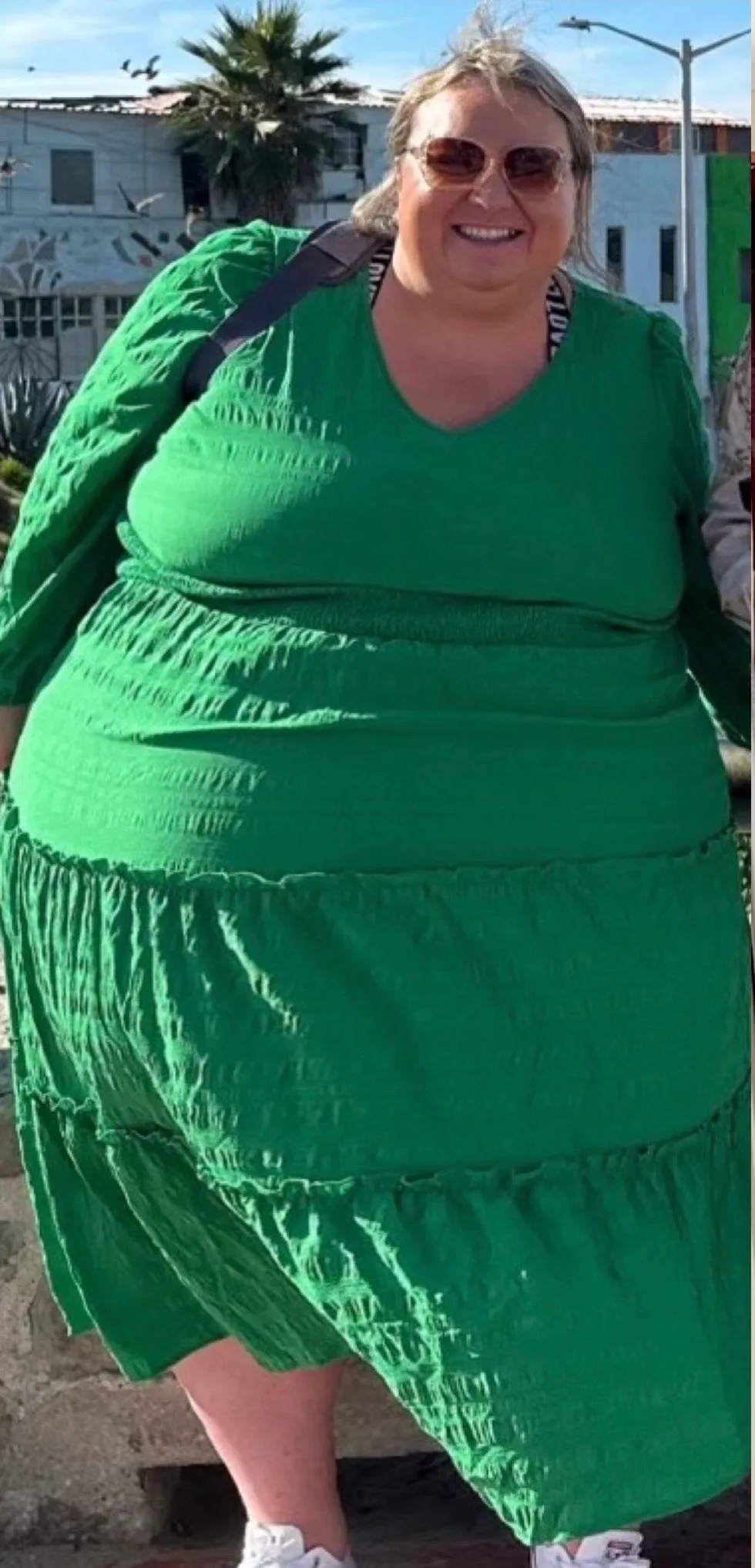 woman before weight loss surgery