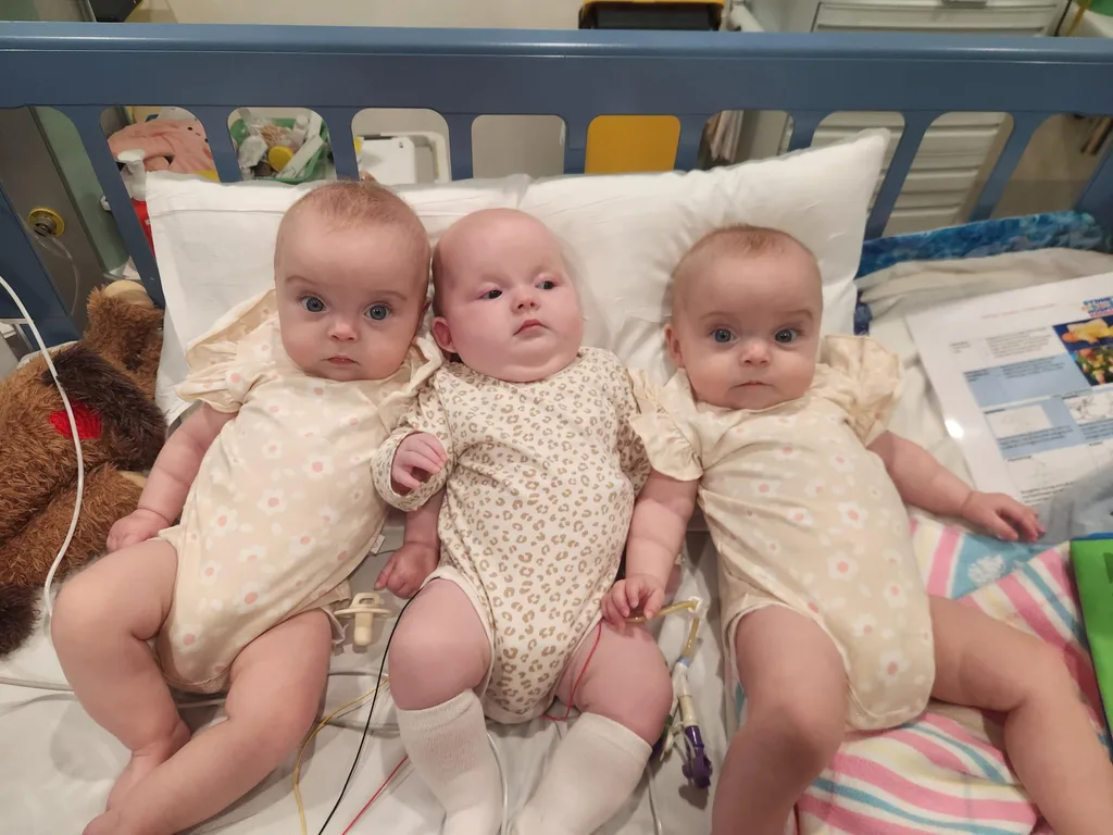 Image of triplets