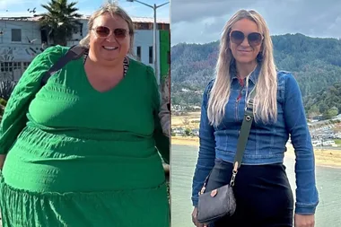 Left image - woman before weight loss surgery Right image - woman after weight loss surgery
