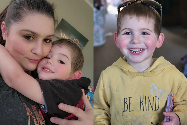 My five-year-old was born without a bum