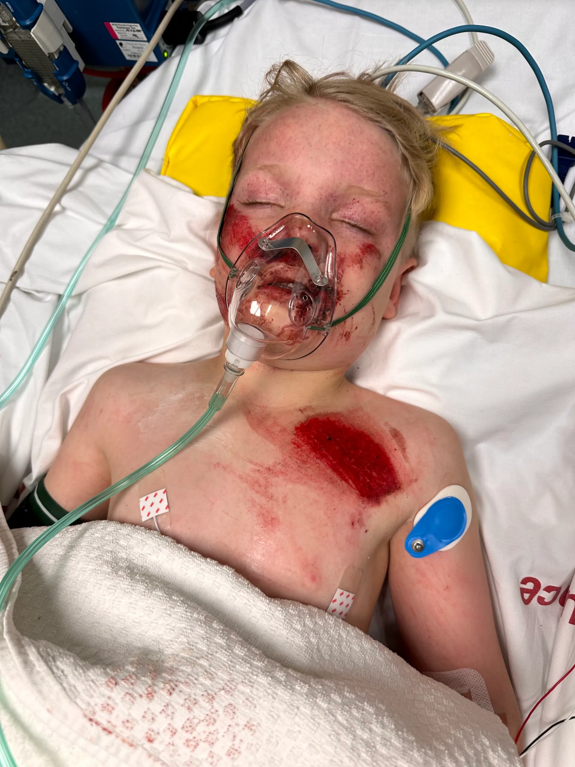 boy in hospital bed