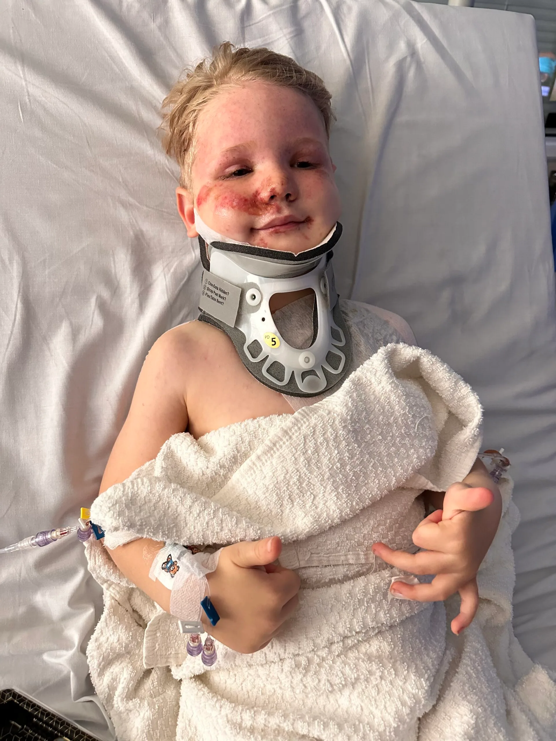 body in hospital bed with neck collar