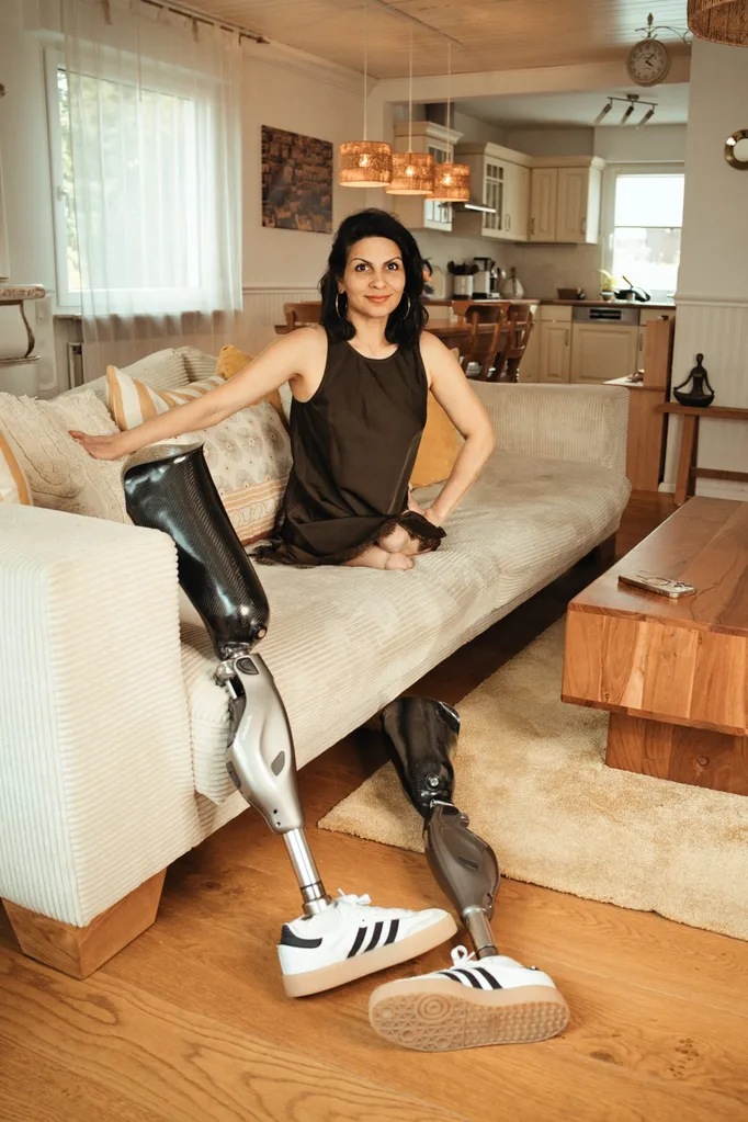 Image of woman with prosthetic legs