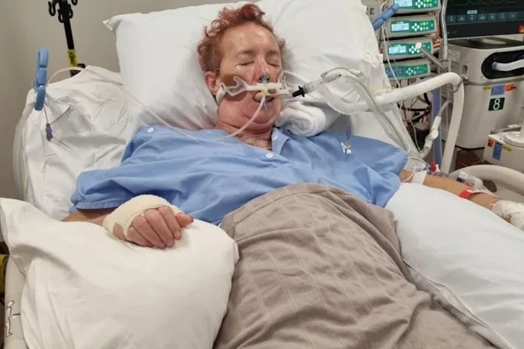 Unconscious woman on breathing support laying in hospital bed.