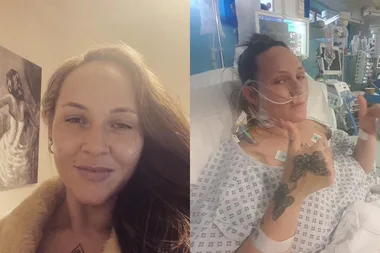 Left image - woman smiling Right image - woman recovering from carbon monoxide poisoning in hospital