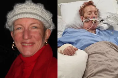 Left: Woman wearing red coat over red turtleneck and white beanie, looking at camera and smilling. Right: Unconscious woman on breathing support laying in hospital bed.