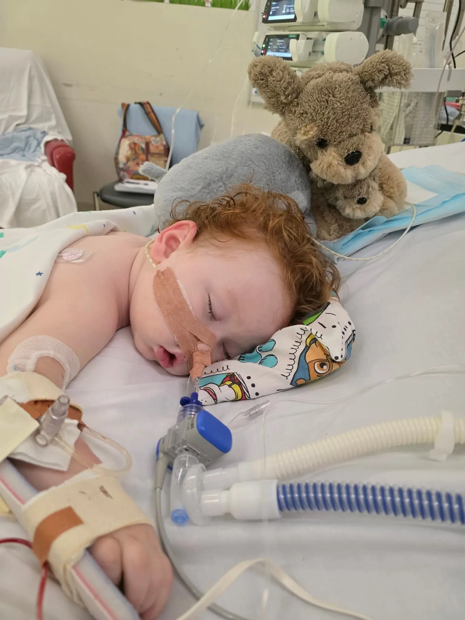 Image of toddler in coma