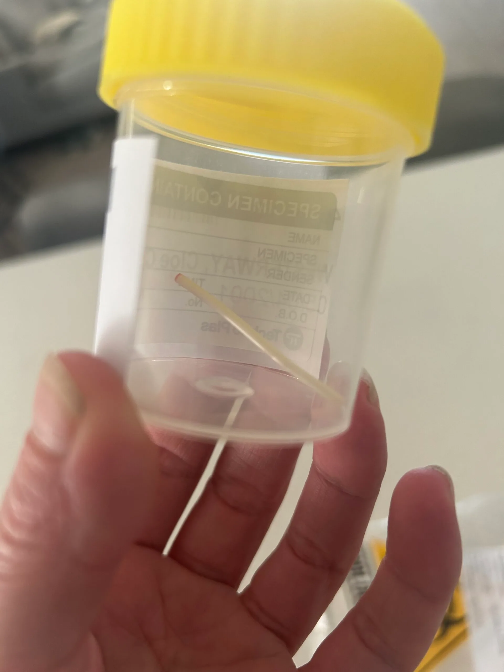 Image of contraceptive implant