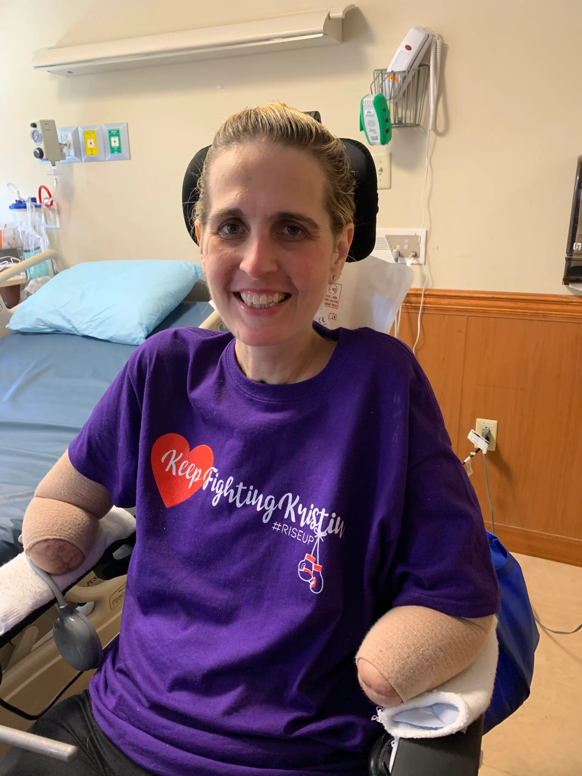 Image of woman after sepsis