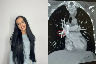 Left image - Woman with long black hair Right image - xray of heart