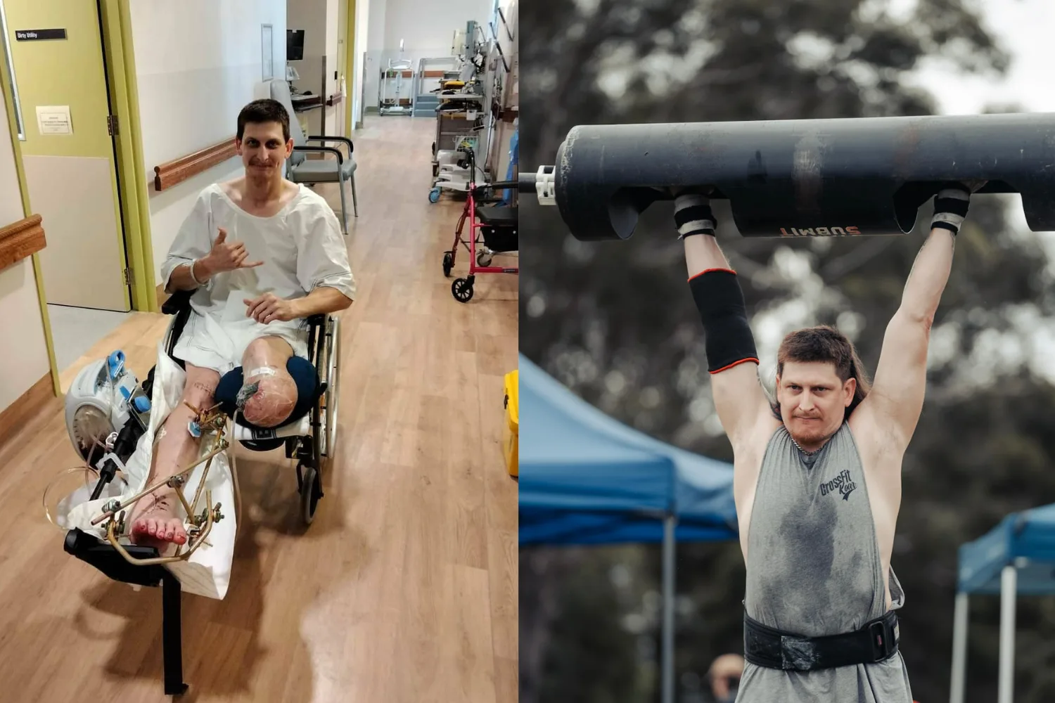 Left: Man in hospital gown, sitting on wheelchair and right leg amputated. Right: Man wearing grey singlet holding up a barbell.