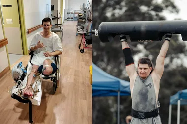 Left: Man in hospital gown, sitting on wheelchair and right leg amputated. Right: Man wearing grey singlet holding up a barbell.