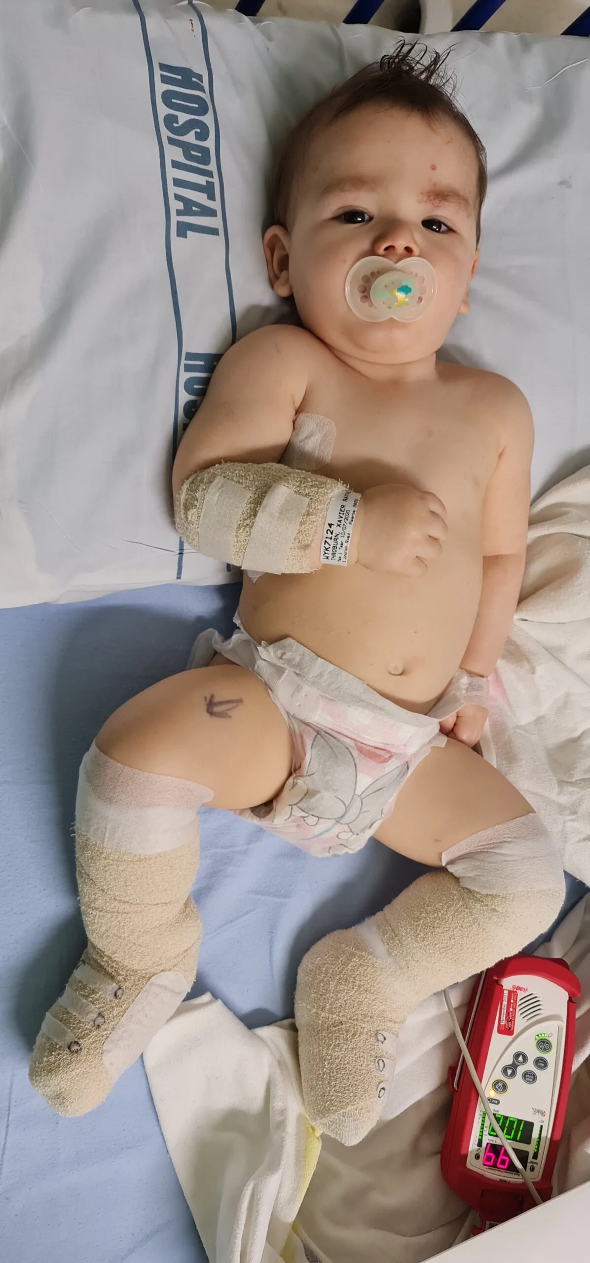 Xavier in hospital