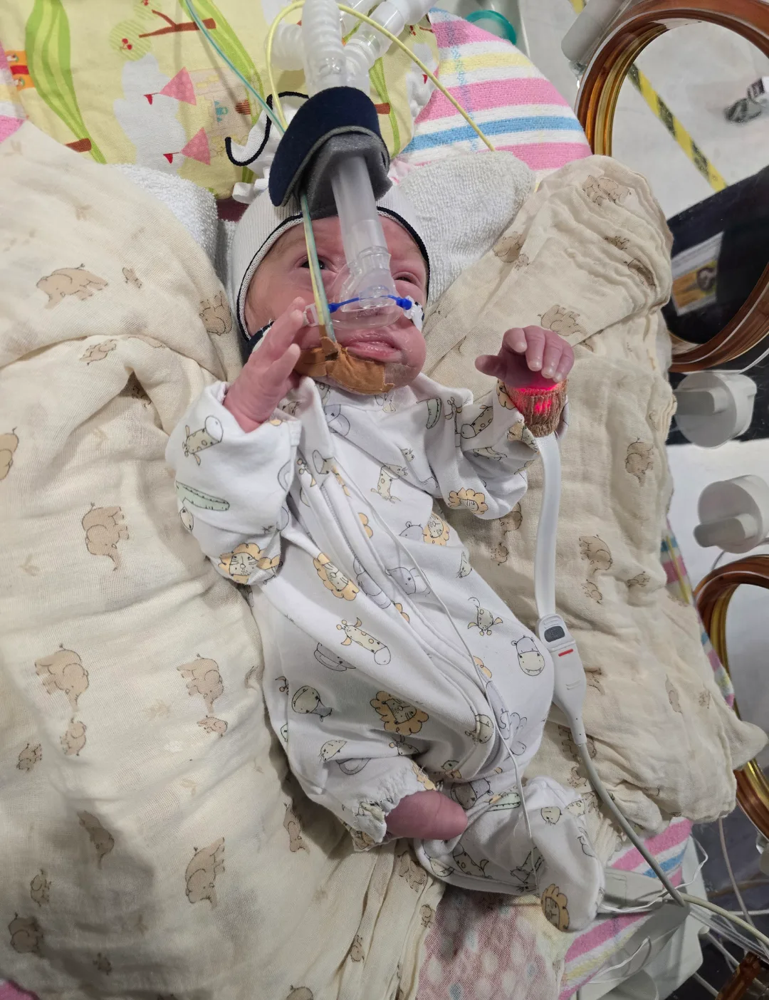 Baby in NICU wearing a onesie and has oxygen mask connected to nose.