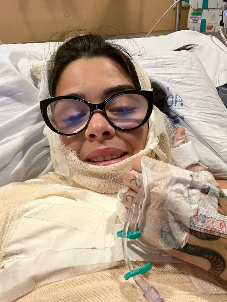 Image of woman recovering from burns in hospital
