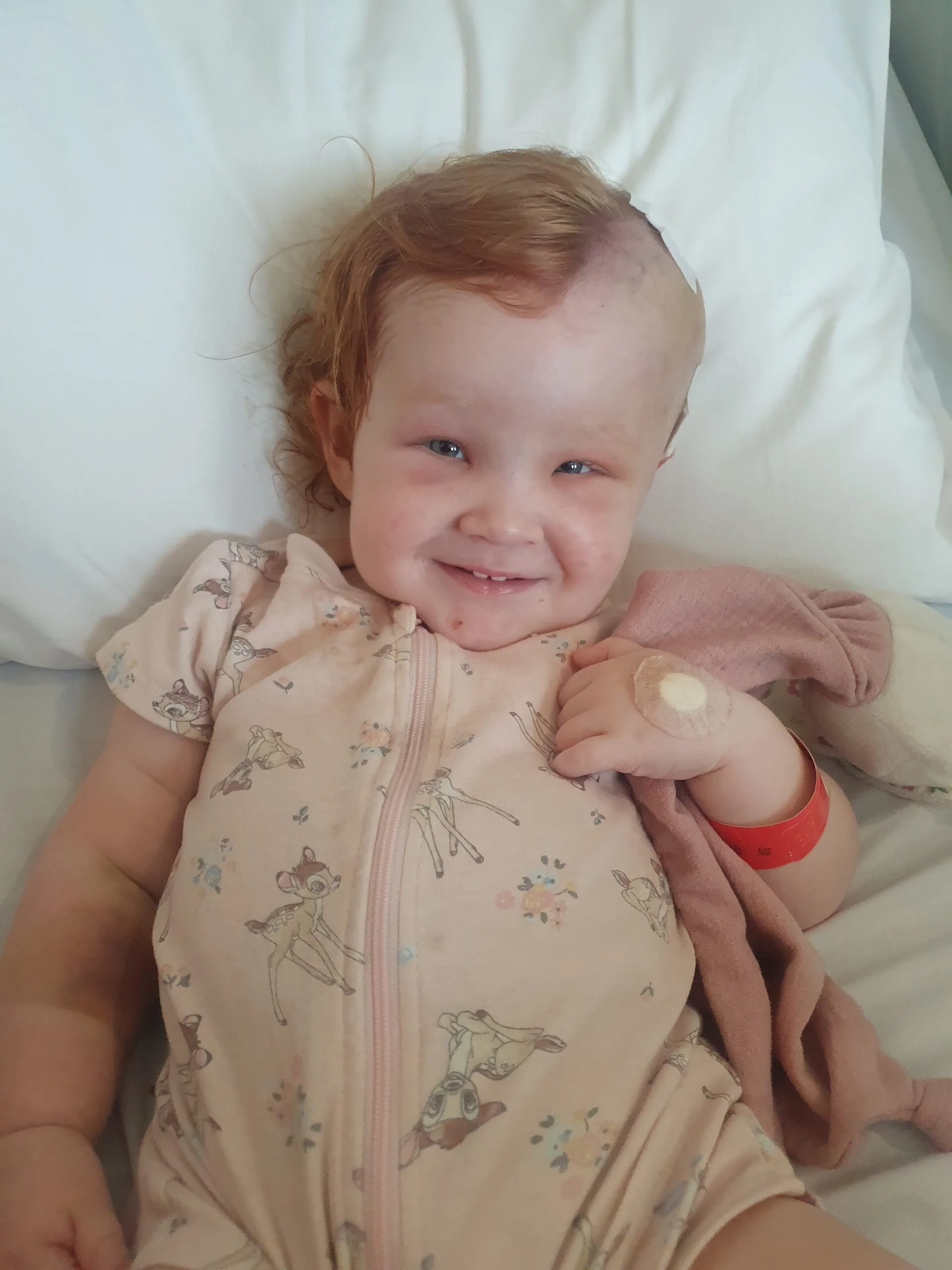 Image of little girl recovering from accident