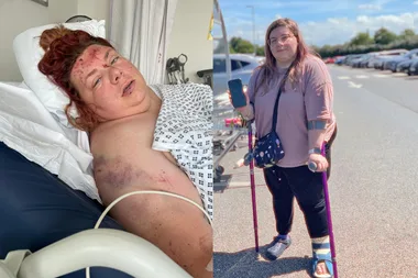 Mum’s car plunged 100 metres – then burst into flames. This is her now.