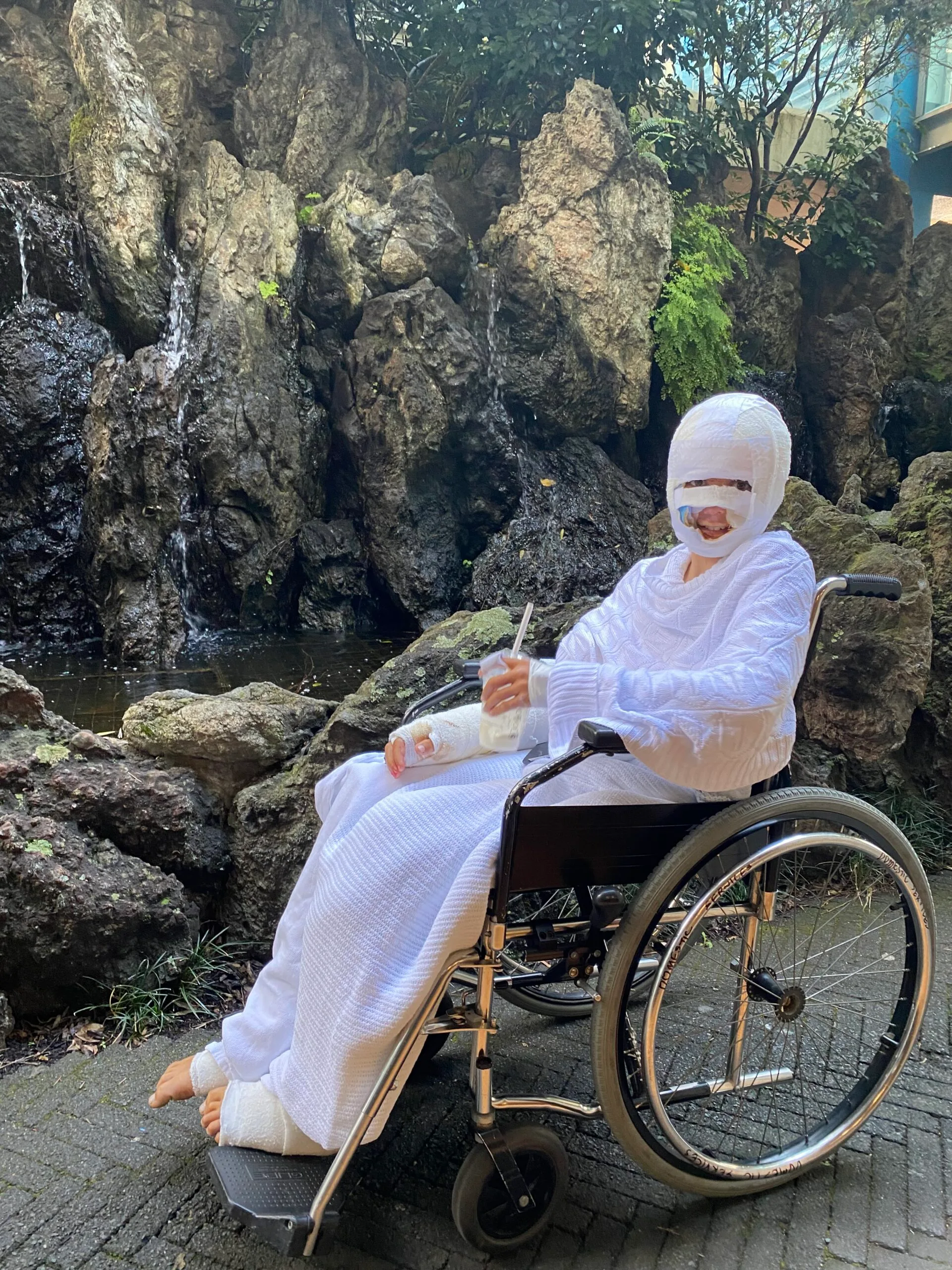 Young boy covered head to toe in bandages sitting on a wheelchair.