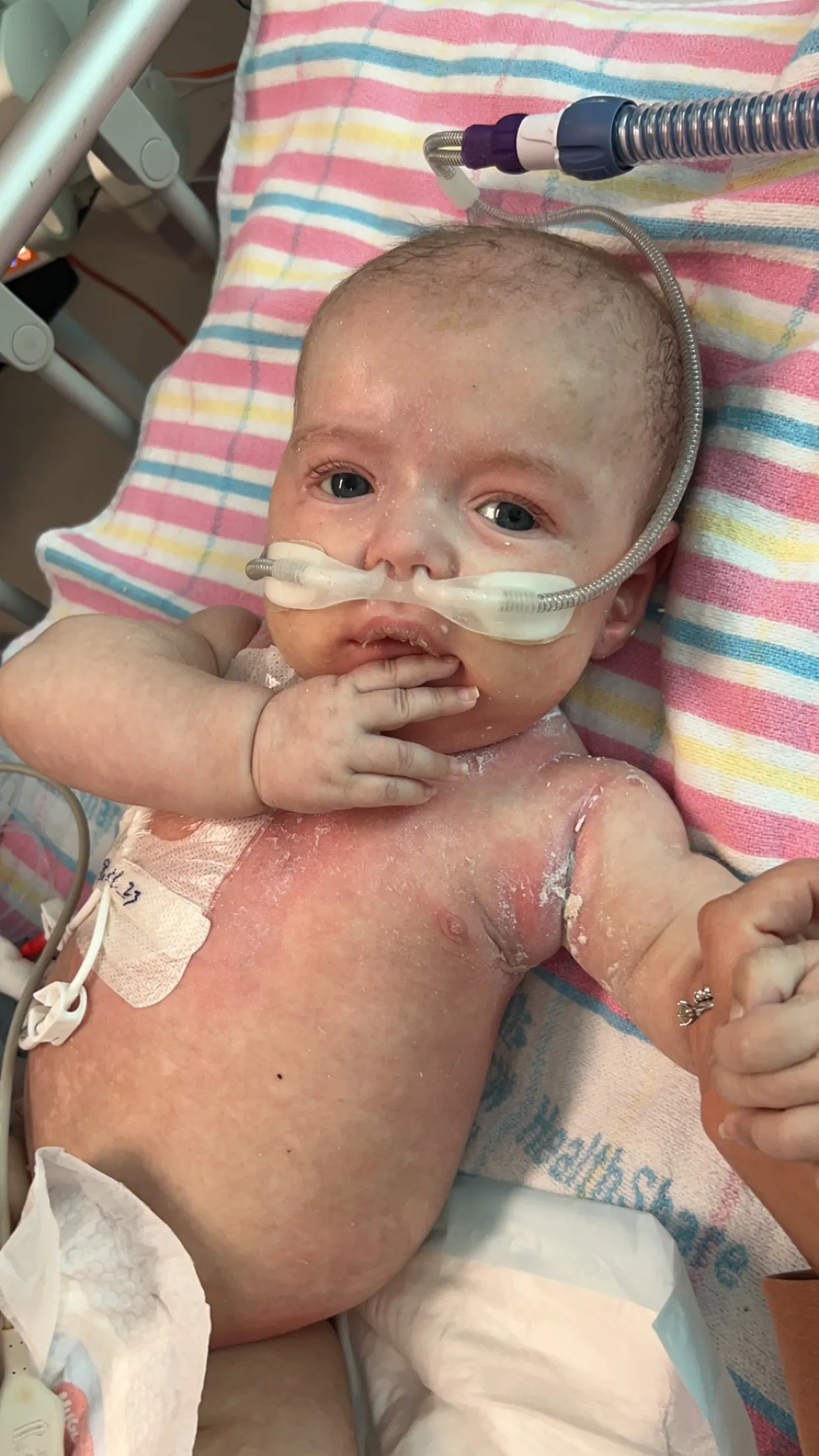 Newborn baby in hospital with oxygen mask hooked to nose, staring at camera. 