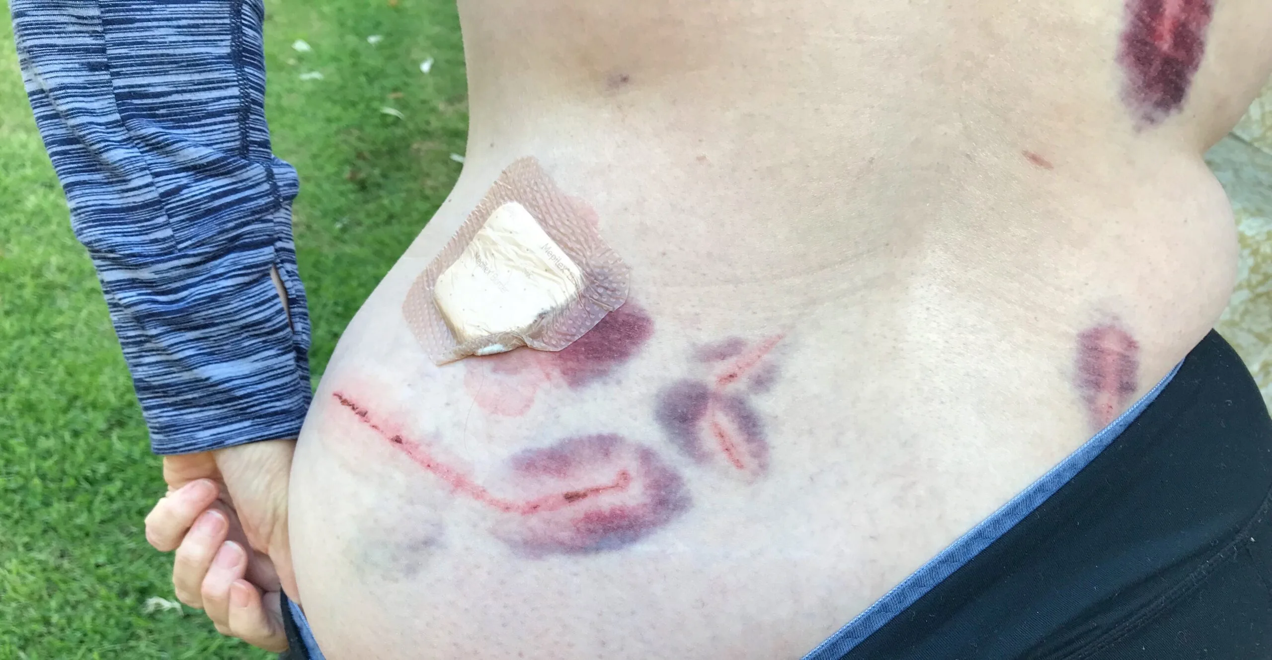 Image of injuries
