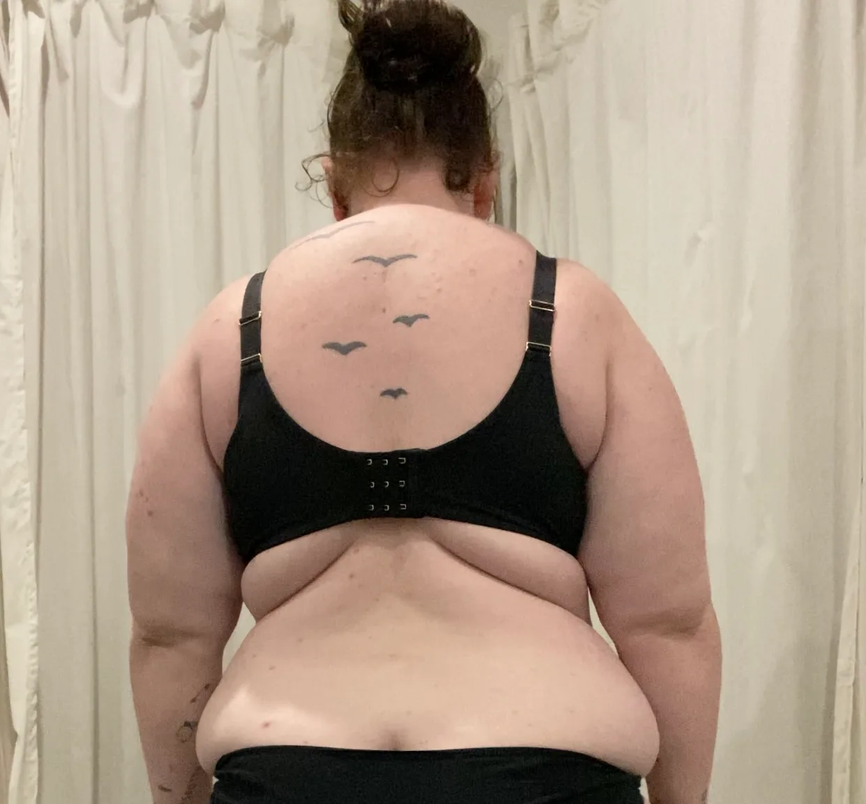 Photo of overweight woman's back with excessive fat.