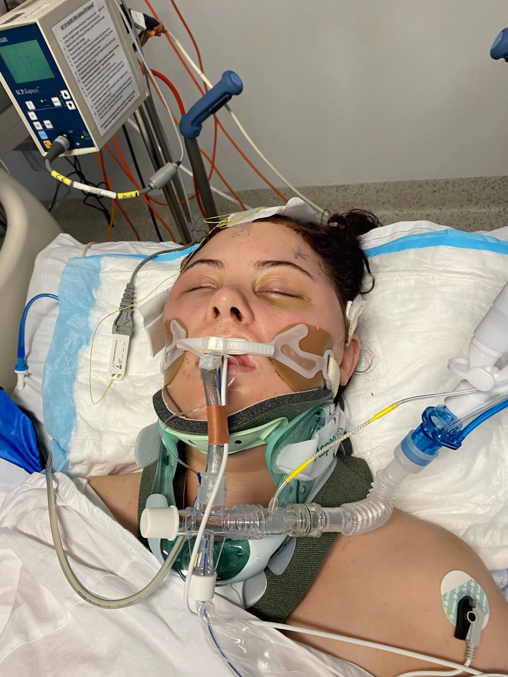 Image of woman in coma