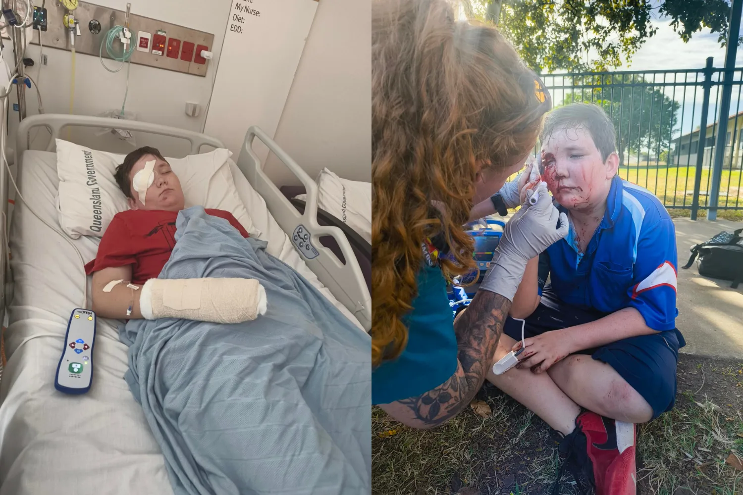 Left image - Boy recovering from accident in hospital Right image - young boy at school after accident