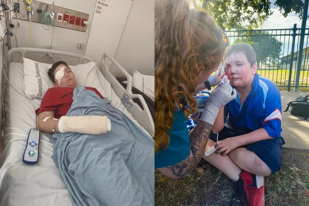 ‘Tell them to slow down’: Mum’s plea after her son was near blinded in an e-scooter accident