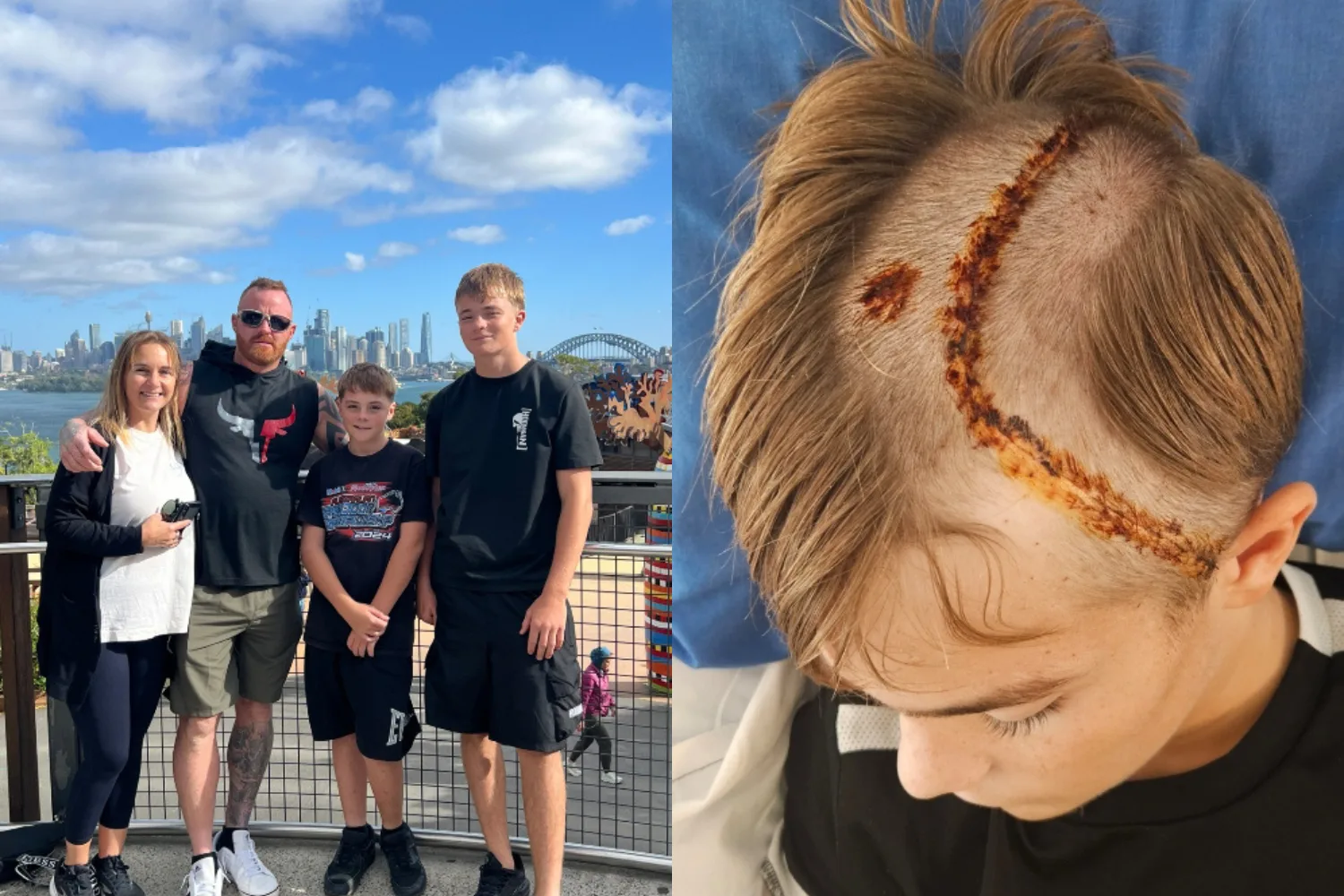 Left image - Family of four standing in front of Sydney Harbour Bridge Right image - Boy recovering from brain surgery