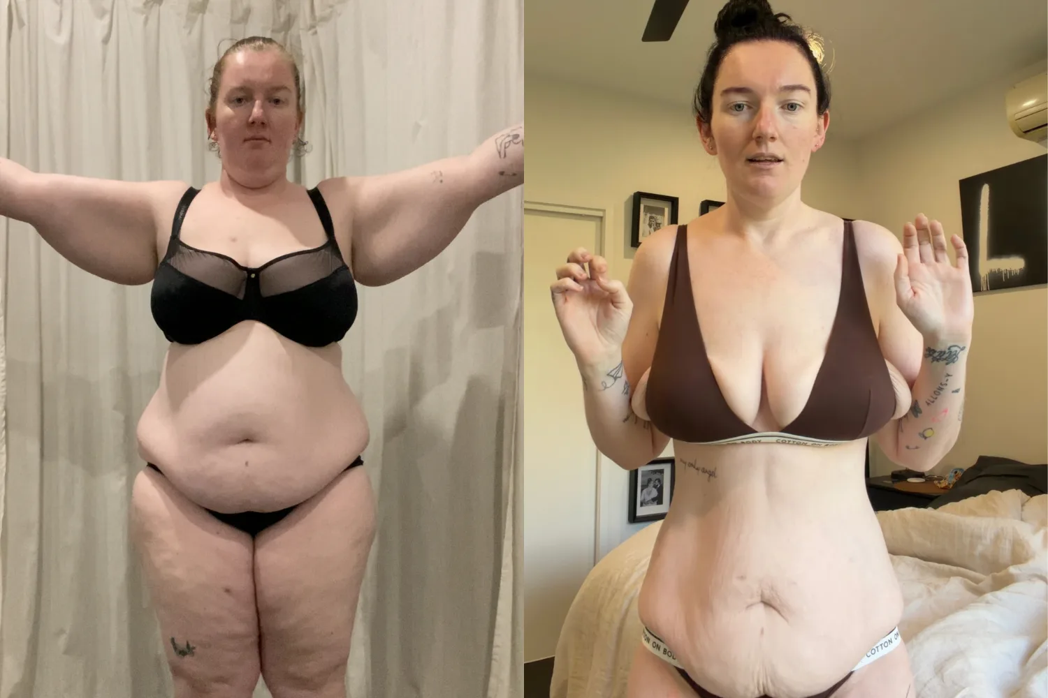 Left: Overweight woman in bra and underwear Right: Woman in brown bra and underwear with loose skin in the stomach region.