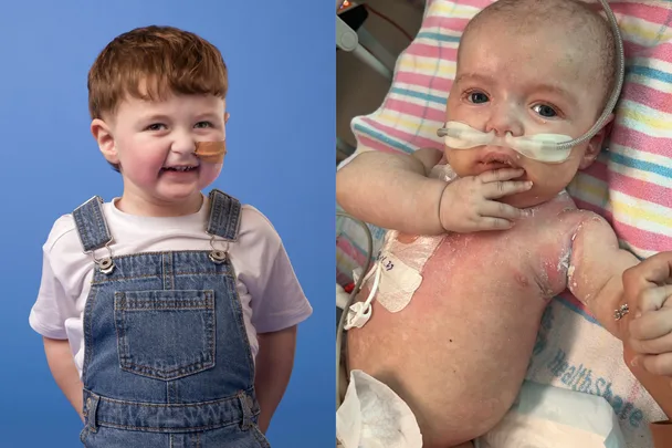 A rare genetic disorder broke all my baby’s bones. This is his life now