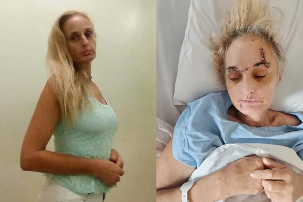‘It looked like a slaughterhouse’: Survivor recalls horrific axe attack