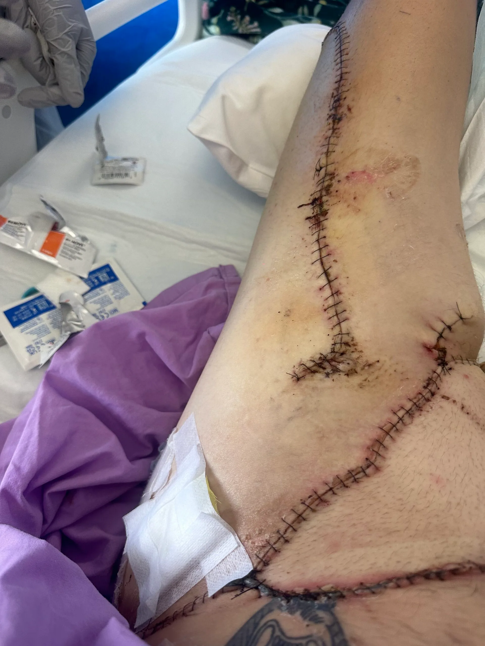 Image of boys leg injuries