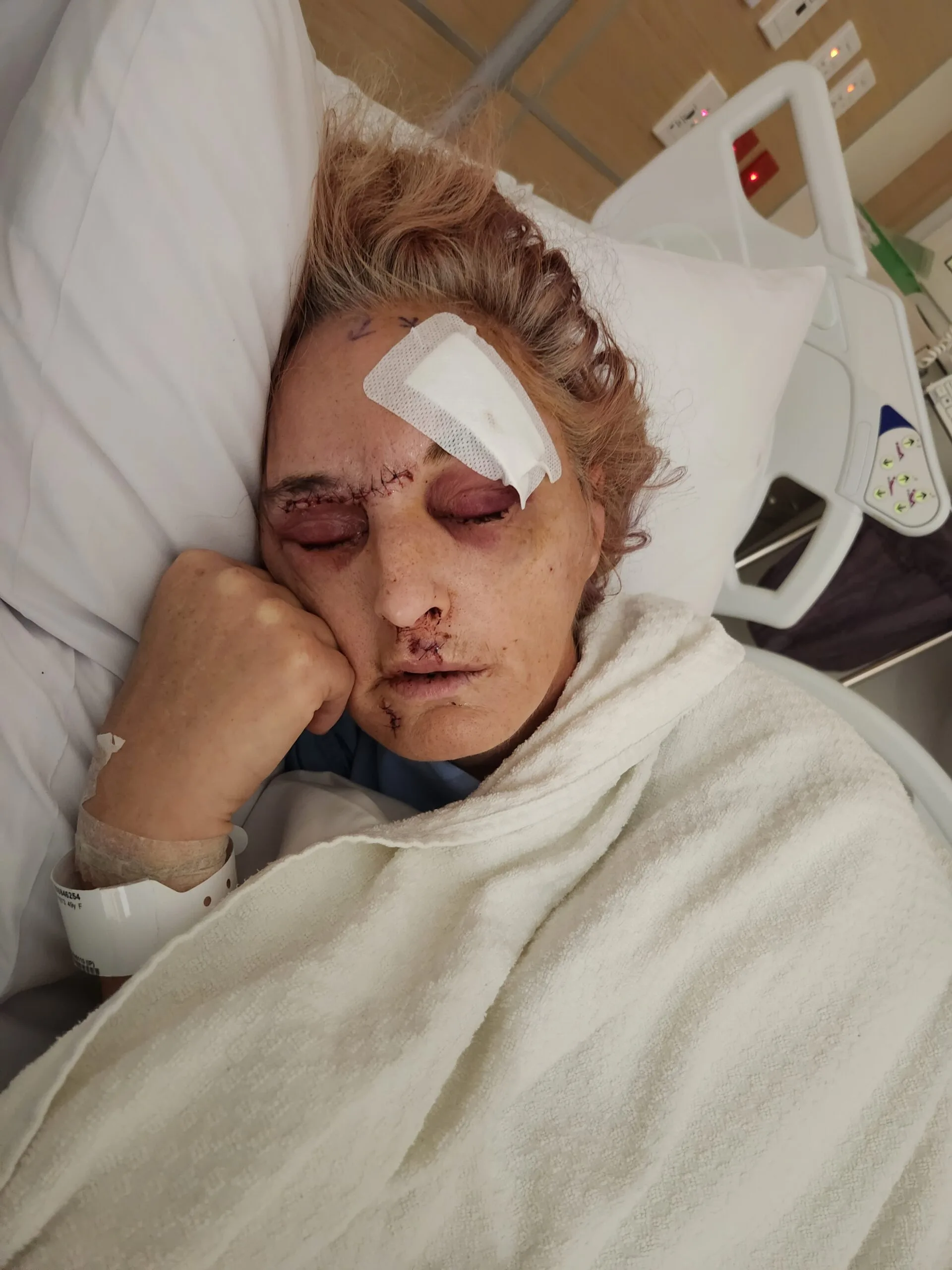 woman in hospital bed sleeping