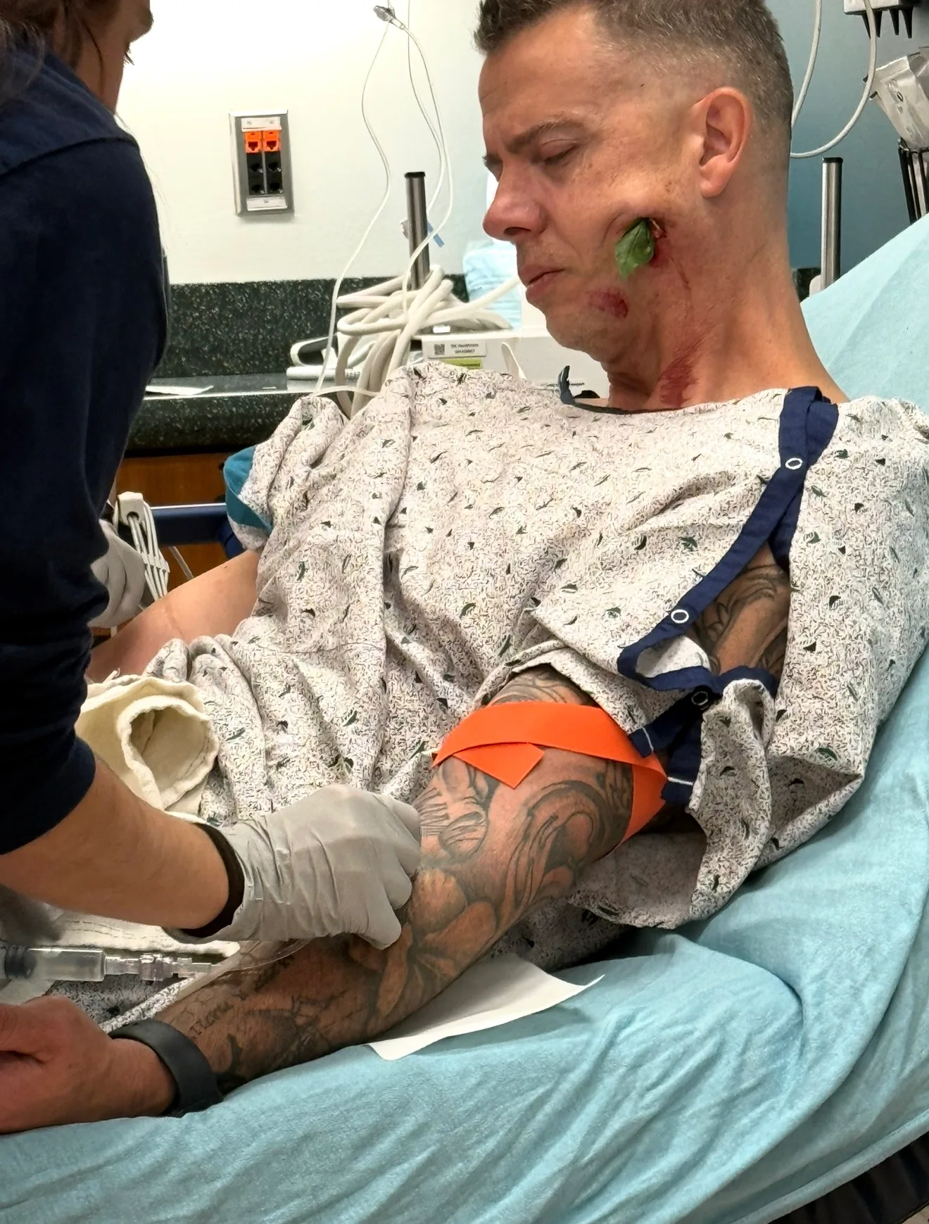 Image of man in hospital after being impaled by tree branch in face