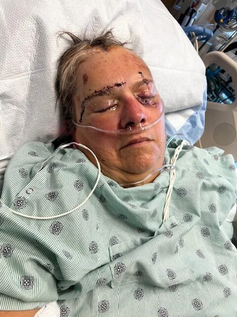woman in hospital bed with head wounds