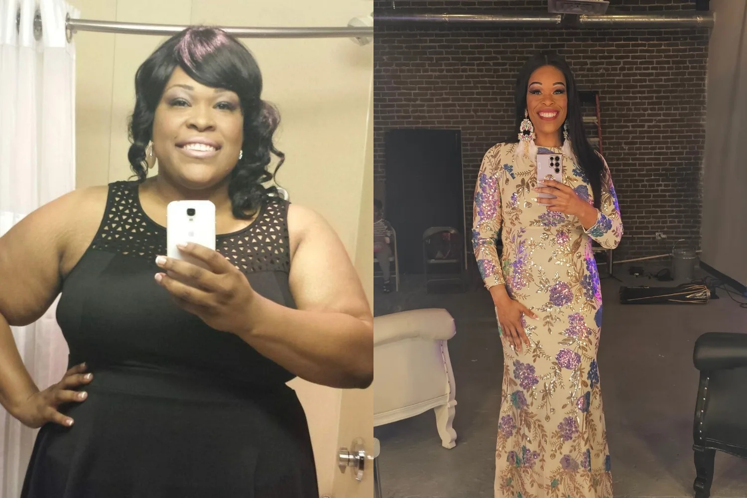 Left image - before weightloss Right image - after weightloss