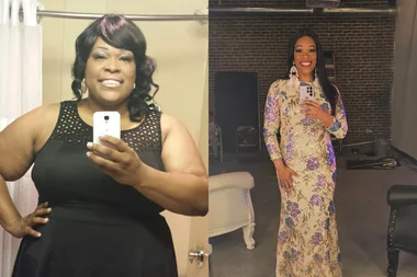 Left image - before weightloss Right image - after weightloss